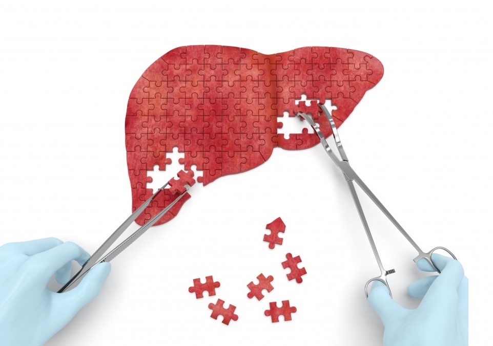 Everything about liver transplant procedure | Healing Consulting Turkey