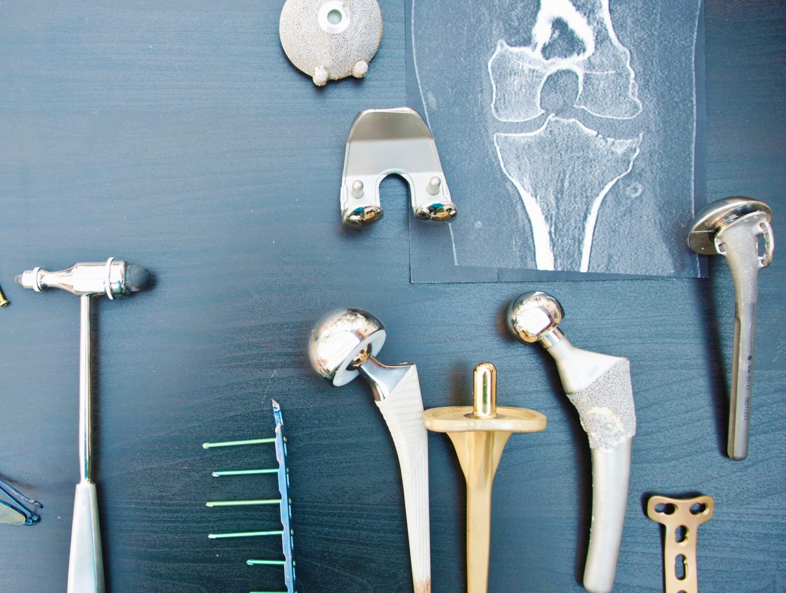 Overview about orthopedic surgery methods Healing Consulting Turkey