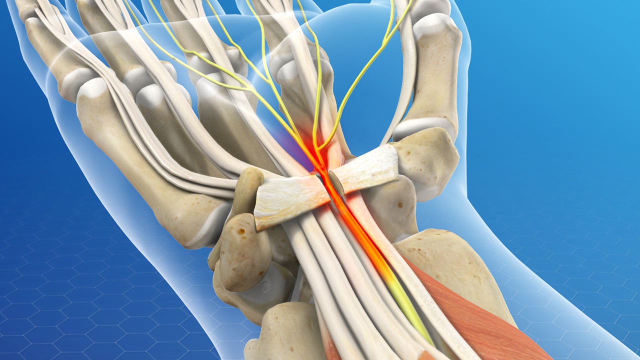 peripheral nervous surgery