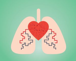 pulmonary transplantation operation