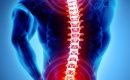 spinal cord tumor surgery