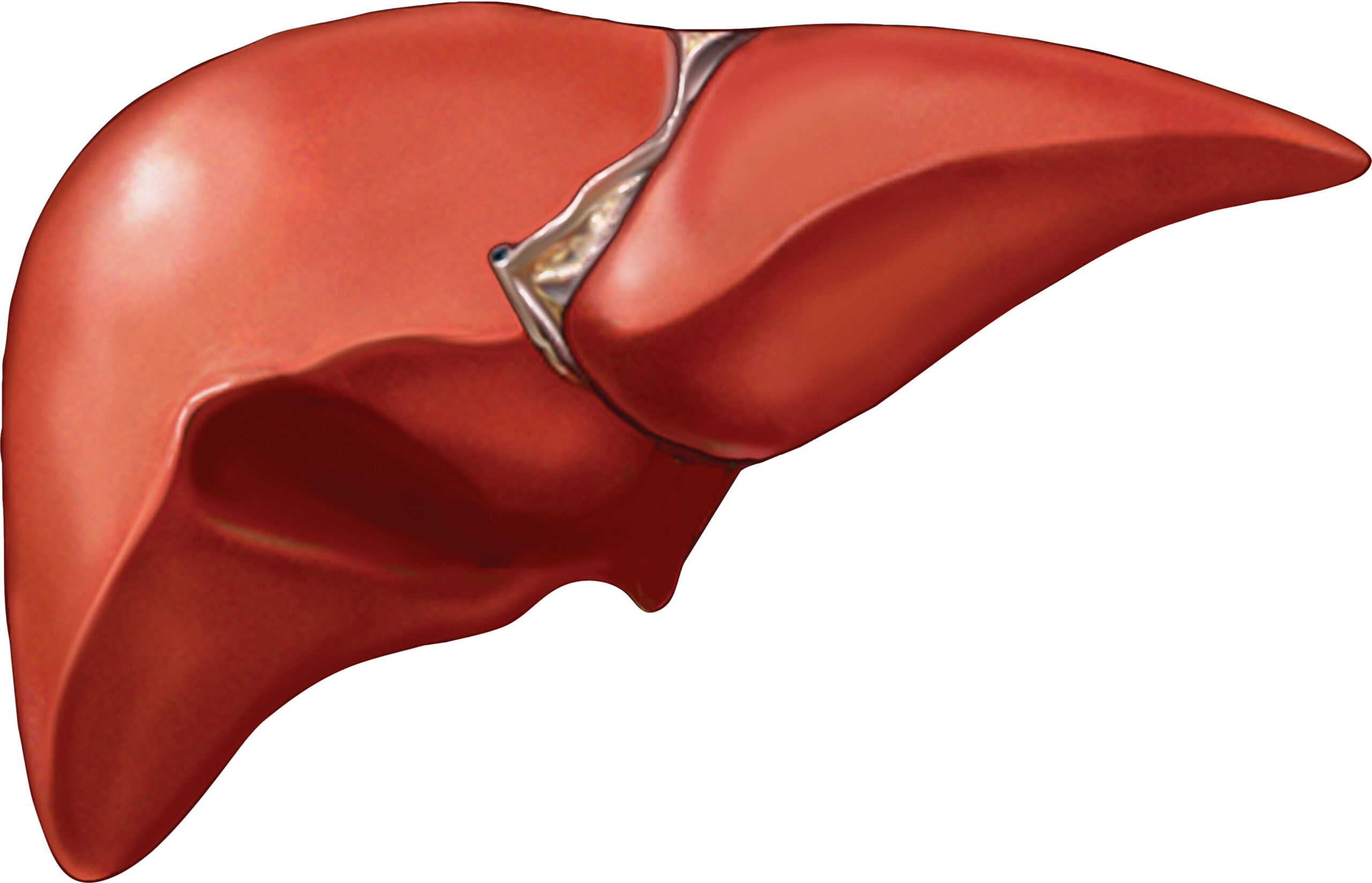 hepatectomy