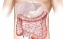 small bowel resection