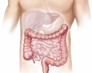 small bowel resection