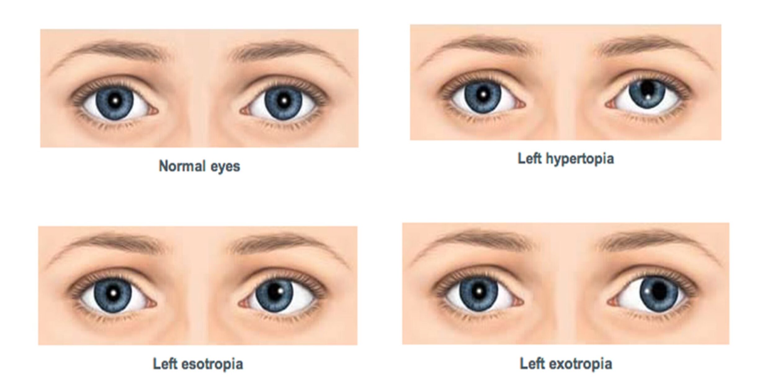 علاج حول العين