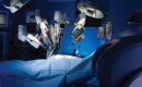 robotic surgery for heart